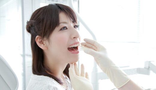 【2025最新】ホワイトニング北海道おすすめ4選！評判のいい人気歯科クリニックを厳選！