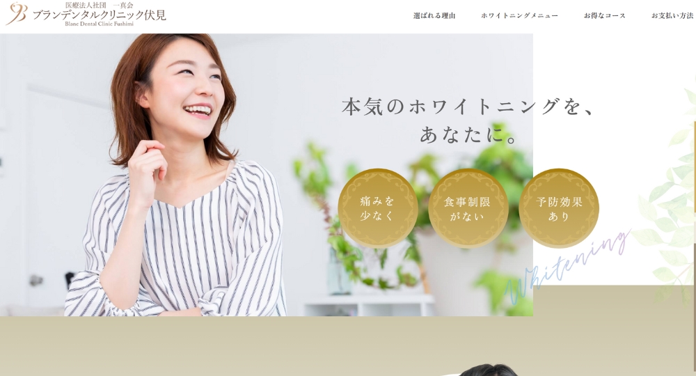 歯のホワイトニング_札幌_札幌ブランデンタルクリニック伏見